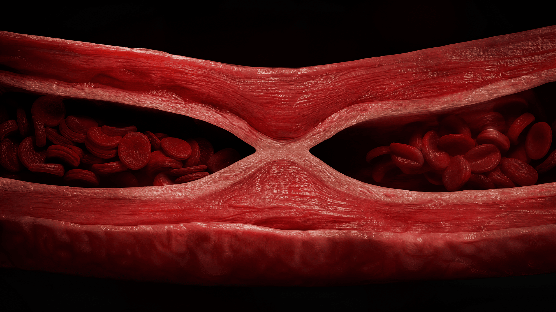 Flujo de sangre reducido