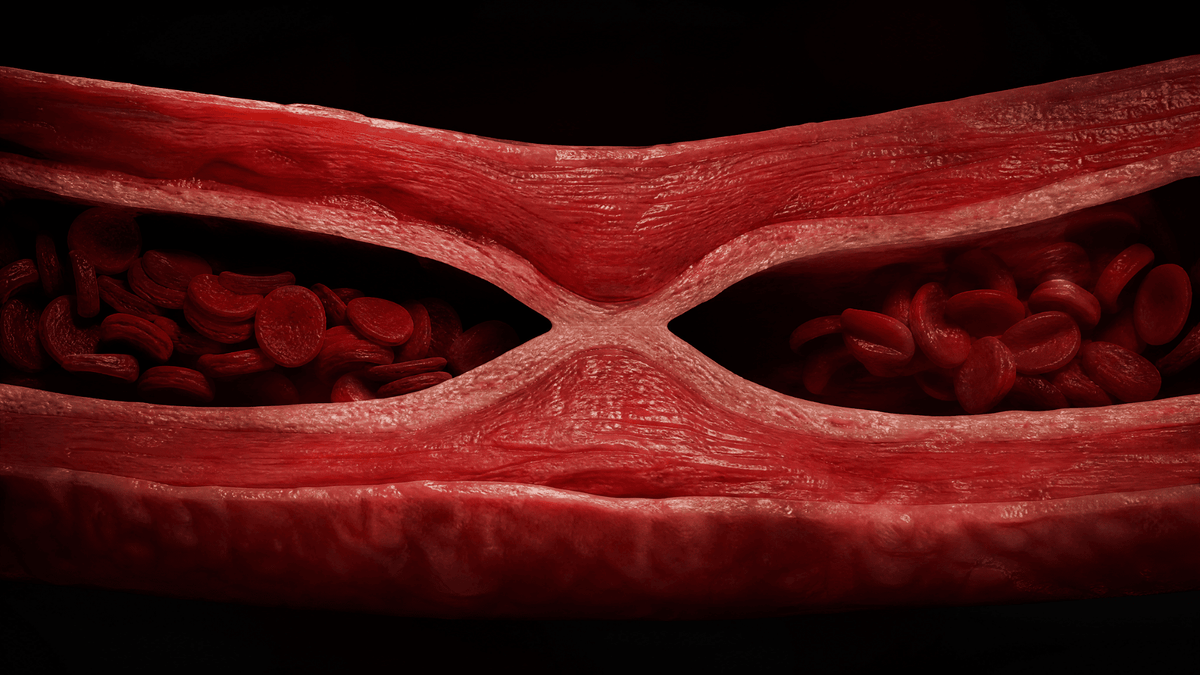 Flujo de sangre reducido